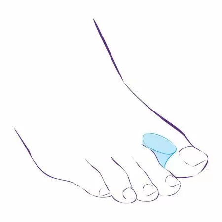 Разделитель межпальцевый Тривес СТ-51, увеличенные размеры