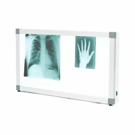 Негатоскоп общего назначения Армед 2-кадровый