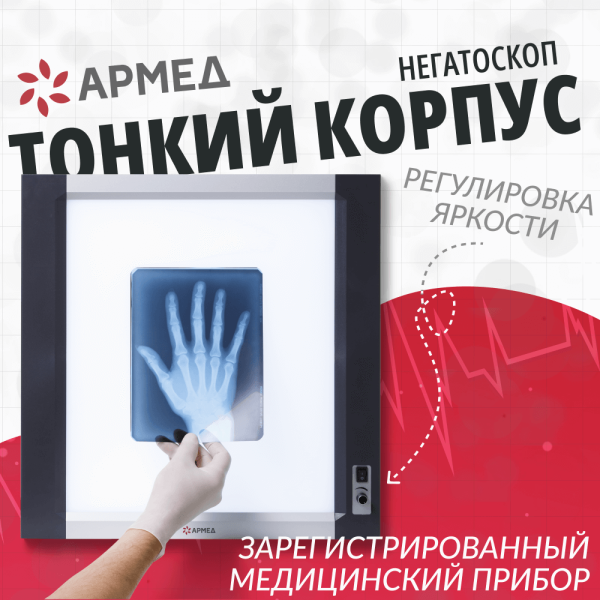 Негатоскоп общего назначения Армед 1-кадровый LUX